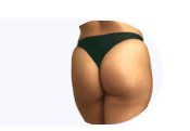 Glúteos